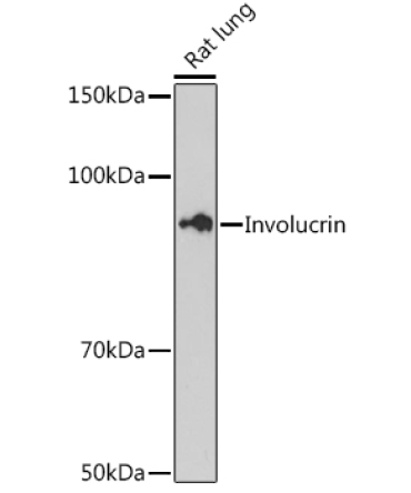 Involucrin Rabbit Monoclonal Antibody