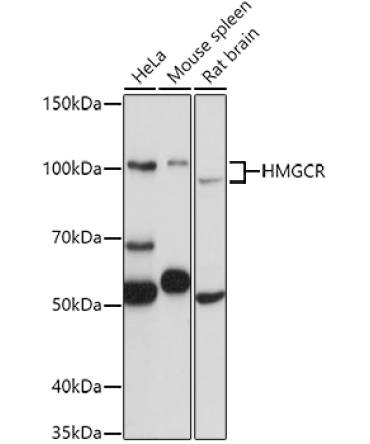 HMGCR Rabbit Polyclonal Antibody