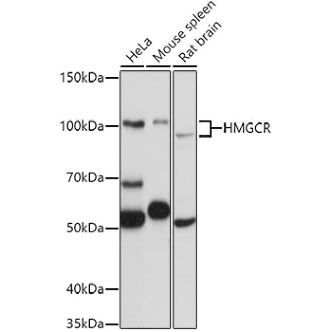 HMGCR Rabbit Polyclonal Antibody