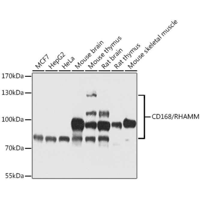 CD168/RHAMM Rabbit Polyclonal Antibody