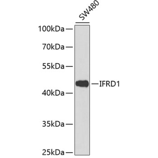 IFRD1 Rabbit Polyclonal Antibody