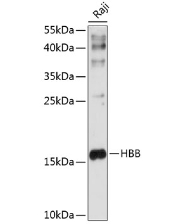 HBB Rabbit Polyclonal Antibody