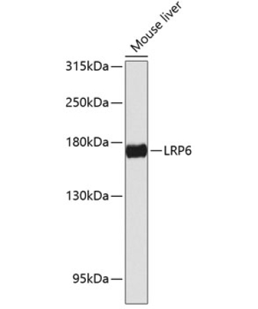 LRP6 Rabbit Polyclonal Antibody