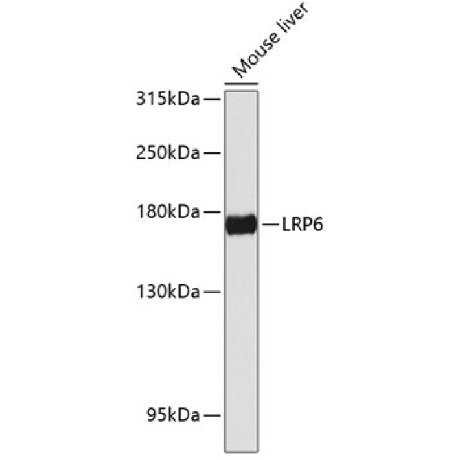 LRP6 Rabbit Polyclonal Antibody