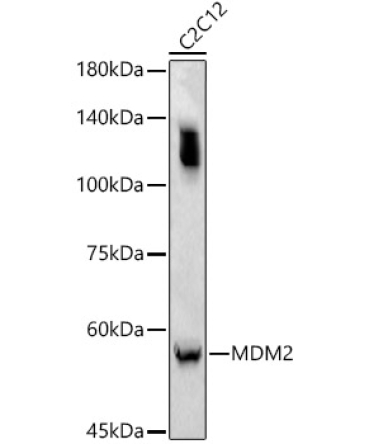 MDM2 Rabbit Polyclonal Antibody