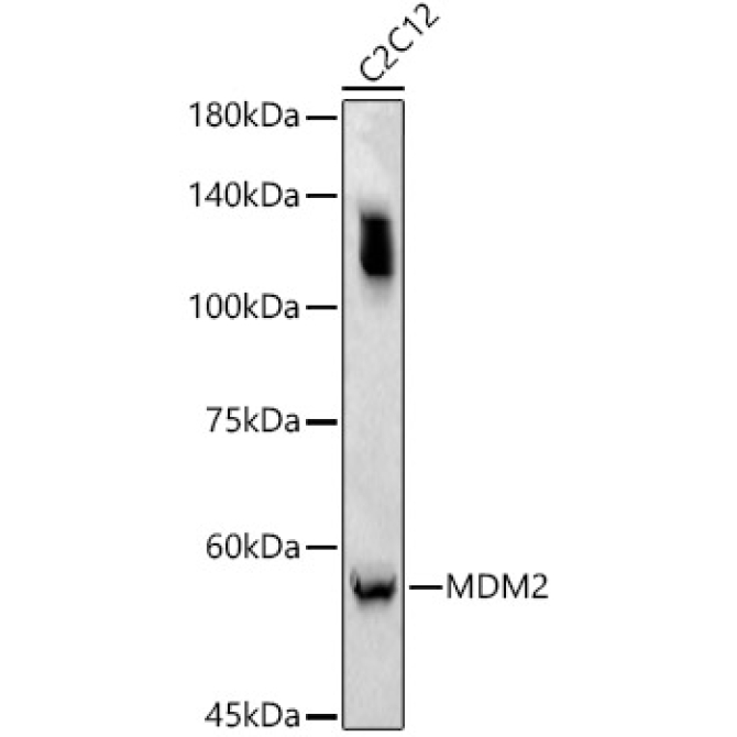 MDM2 Rabbit Polyclonal Antibody