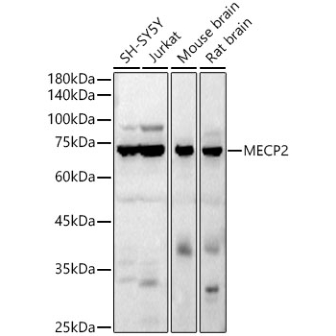 MECP2 Rabbit Polyclonal Antibody