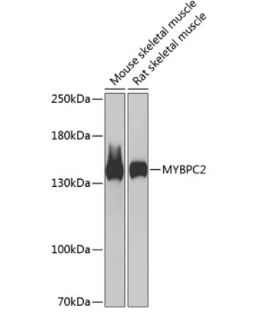 MYBPC2 Rabbit Polyclonal Antibody
