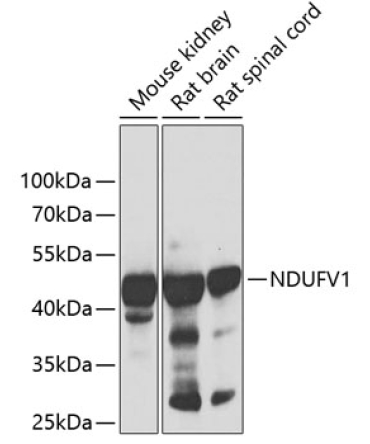 NDUFV1 Rabbit Polyclonal Antibody