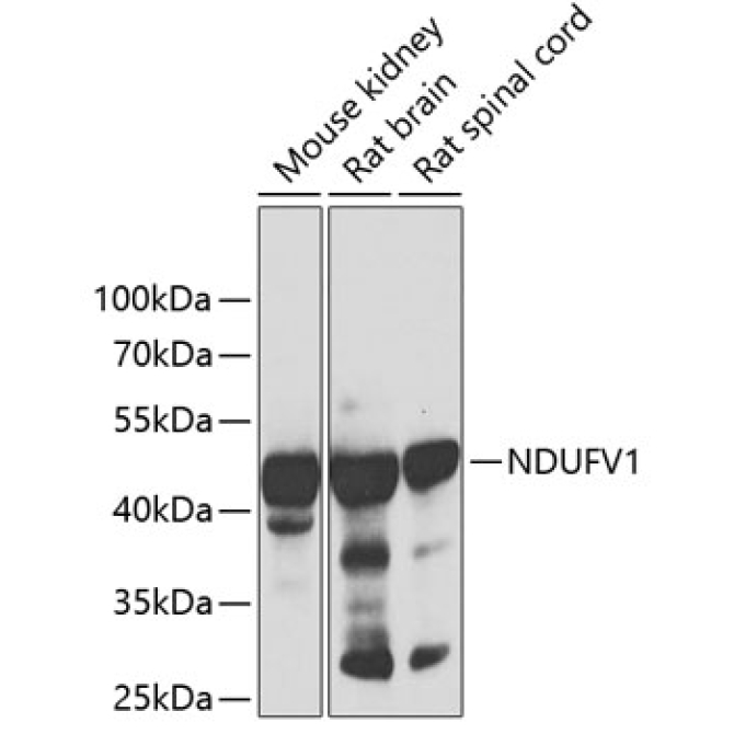 NDUFV1 Rabbit Polyclonal Antibody