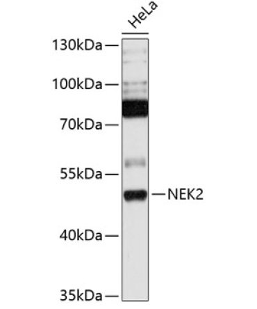 NEK2 Rabbit Polyclonal Antibody