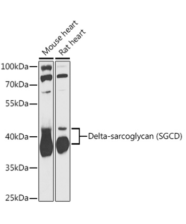 Delta-sarcoglycan (SGCD) Rabbit Polyclonal Antibody