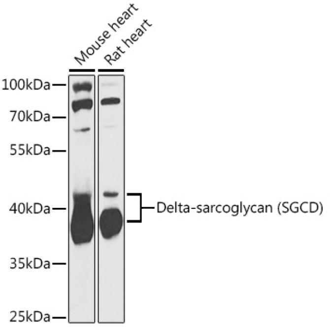 Delta-sarcoglycan (SGCD) Rabbit Polyclonal Antibody