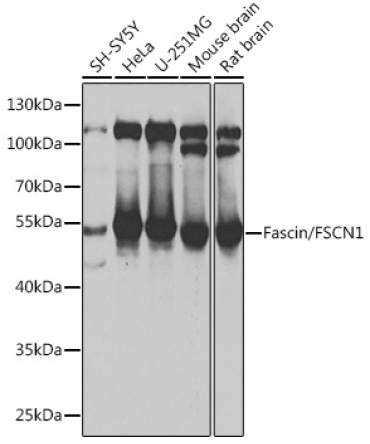 Fascin/FSCN1 Rabbit Polyclonal Antibody