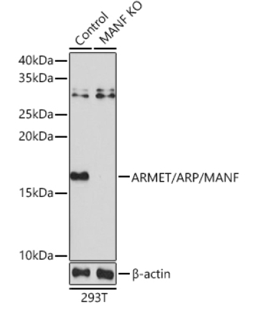 ARMET/ARP/MANF Rabbit Polyclonal Antibody [KO Validated]