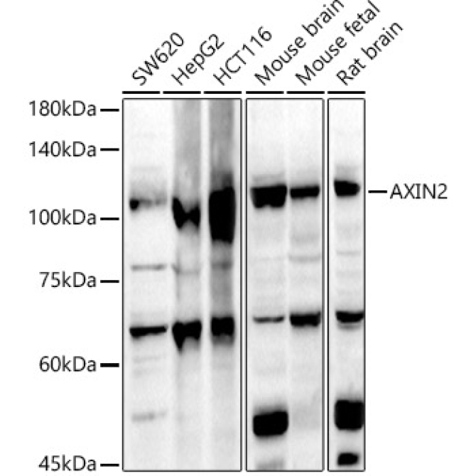 AXIN2 Rabbit Polyclonal Antibody
