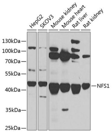 NFS1 Rabbit Polyclonal Antibody