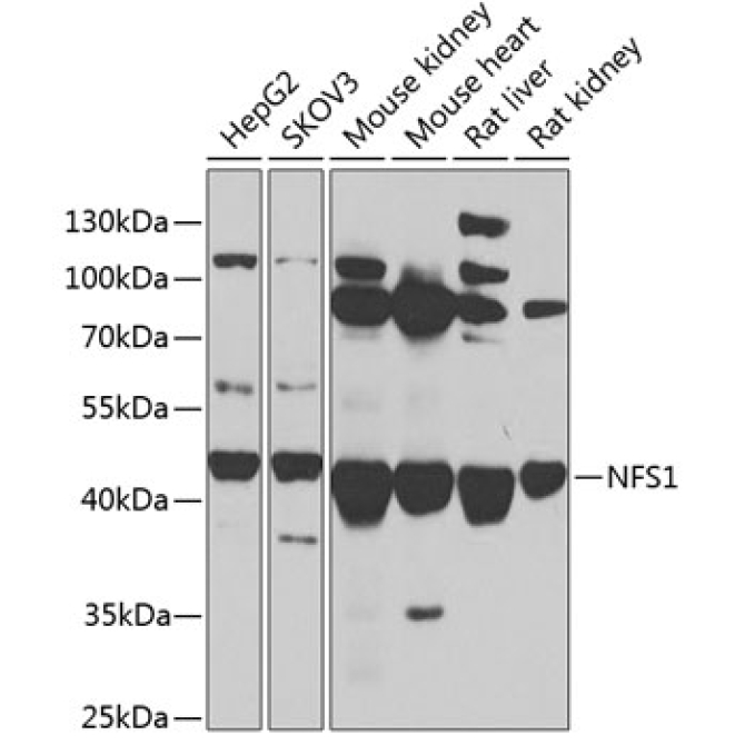 NFS1 Rabbit Polyclonal Antibody