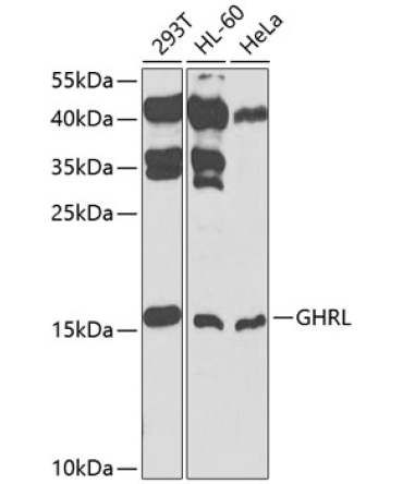 GHRL Rabbit Polyclonal Antibody
