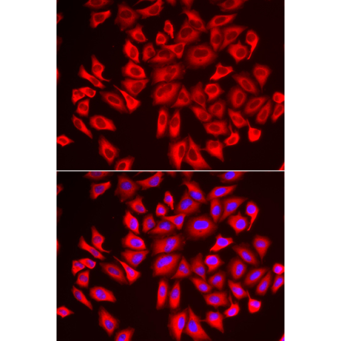 DCAF7 Rabbit Polyclonal Antibody