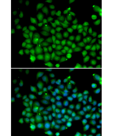 FAT10/UBD Rabbit Polyclonal Antibody