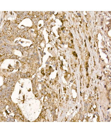 P23/PTGES3 Rabbit Polyclonal Antibody
