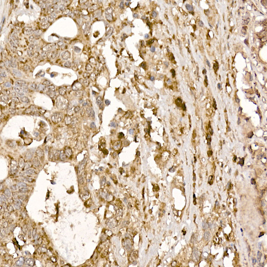 P23/PTGES3 Rabbit Polyclonal Antibody