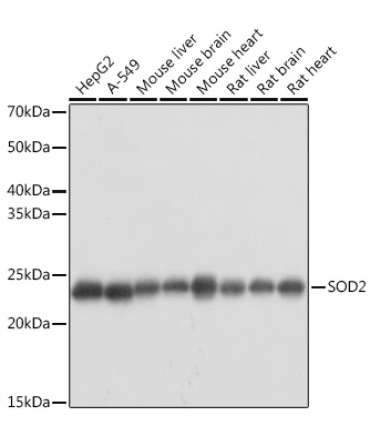 SOD2 Rabbit Polyclonal Antibody [KO Validated]