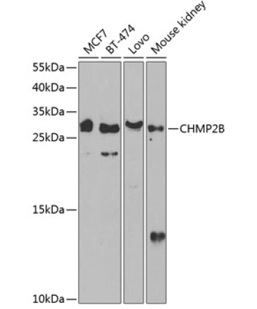 CHMP2B Rabbit Polyclonal Antibody