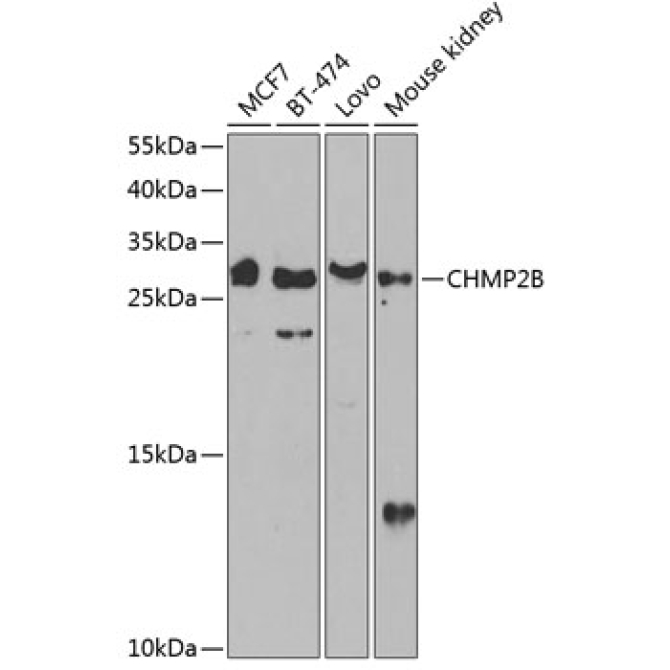 CHMP2B Rabbit Polyclonal Antibody