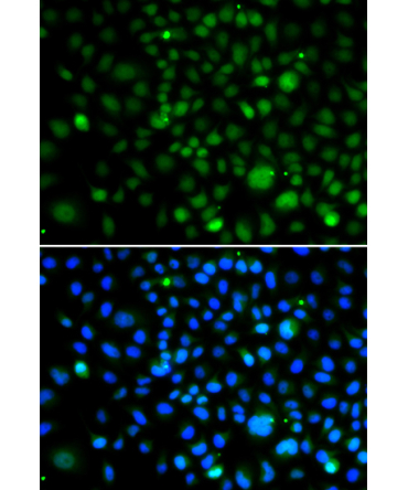 KLF15 Rabbit Polyclonal Antibody