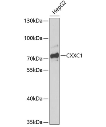 CXXC1 Rabbit Polyclonal Antibody