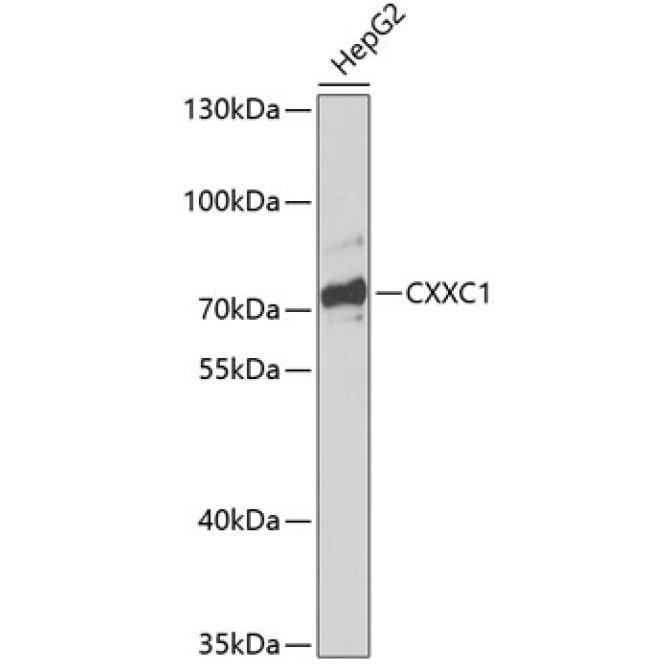 CXXC1 Rabbit Polyclonal Antibody
