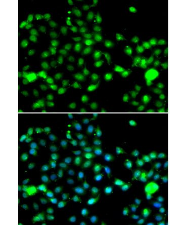 IP6K2 Rabbit Polyclonal Antibody