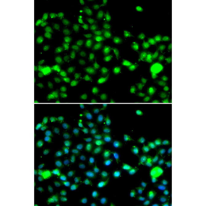 IP6K2 Rabbit Polyclonal Antibody