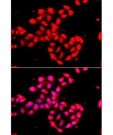 CAMK1D Rabbit Polyclonal Antibody