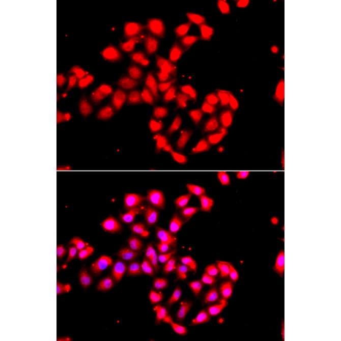 CAMK1D Rabbit Polyclonal Antibody