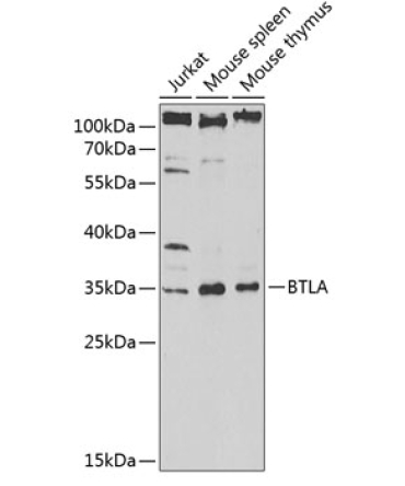 BTLA Rabbit Polyclonal Antibody