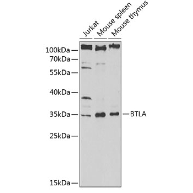 BTLA Rabbit Polyclonal Antibody