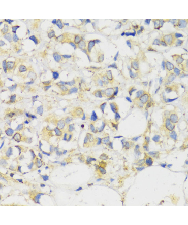 MLKL Rabbit Polyclonal Antibody