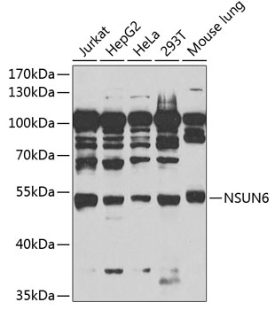 NSUN6 Rabbit Polyclonal Antibody