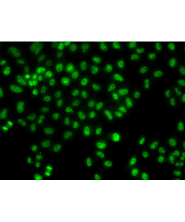 LHX8 Rabbit Polyclonal Antibody