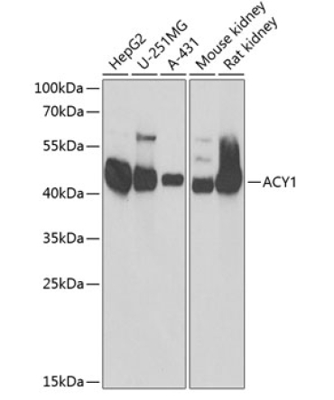 ACY1 Rabbit Polyclonal Antibody