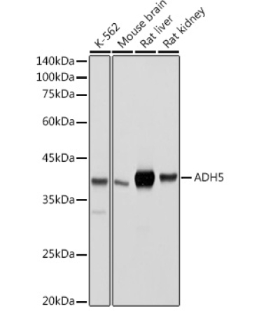 ADH5/GSNOR Rabbit Polyclonal Antibody
