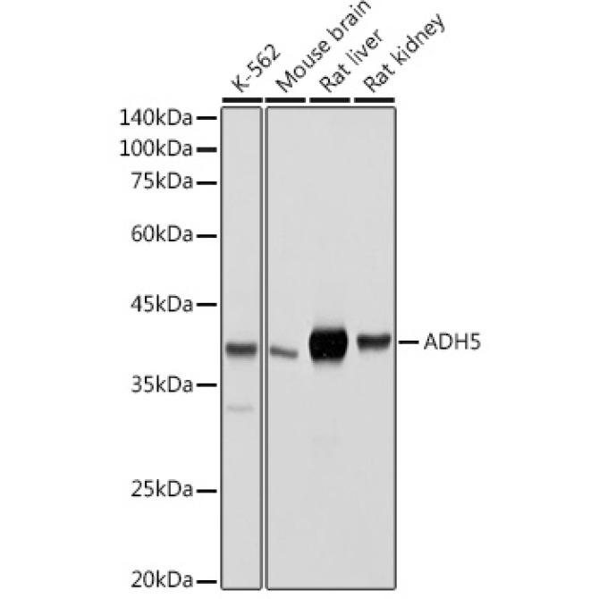 ADH5/GSNOR Rabbit Polyclonal Antibody