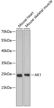 AK1 Rabbit Polyclonal Antibody
