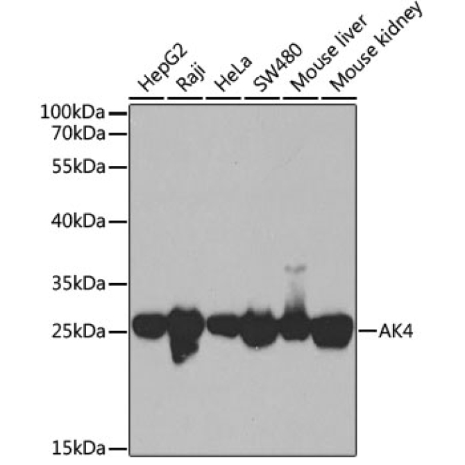 AK4 Rabbit Polyclonal Antibody