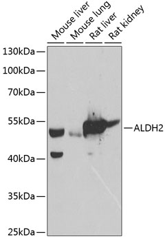 ALDH2 Rabbit Polyclonal Antibody