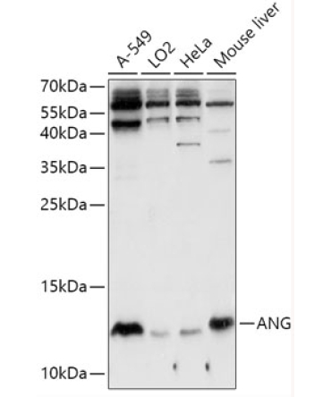 ANG Rabbit Polyclonal Antibody
