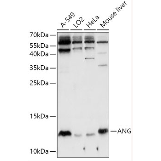 ANG Rabbit Polyclonal Antibody